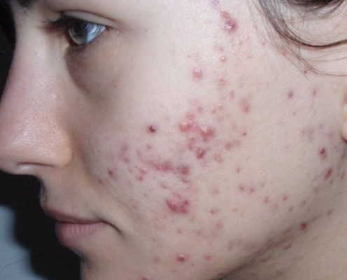 HOW TO EDIT PHOTO A GIRL IMAGE IN PHOTOSHOP