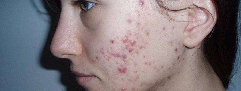 HOW TO EDIT PHOTO A GIRL IMAGE IN PHOTOSHOP